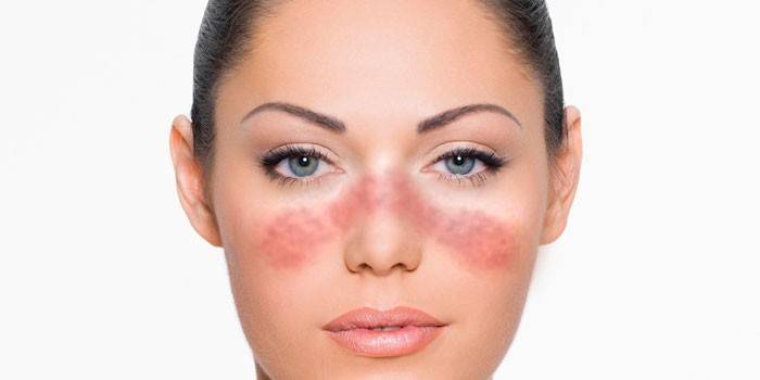 Fata are lupus
