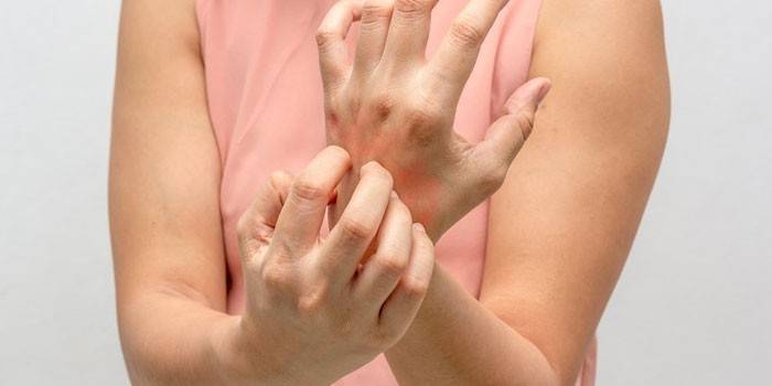 La donna graffia la pelle delle mani