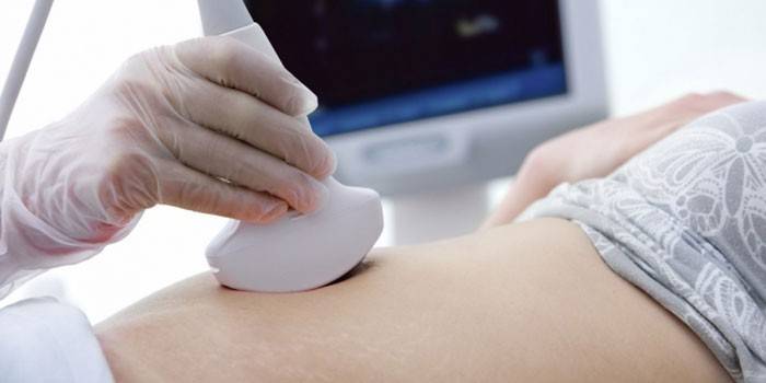 L'échographie des organes pelviens est faite à une fille