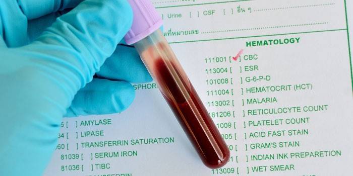 Teste de sangue in vitro