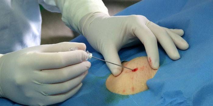 Angiographie