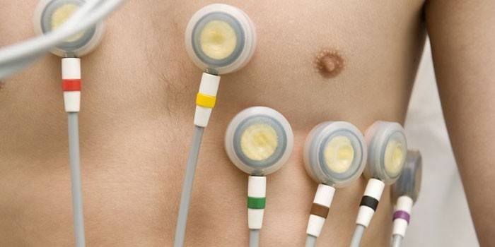 Électrocardiogramme cardiaque pour hommes