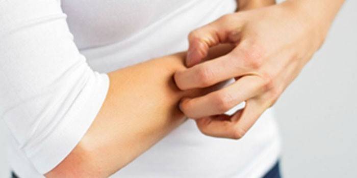 La donna si gratta la mano
