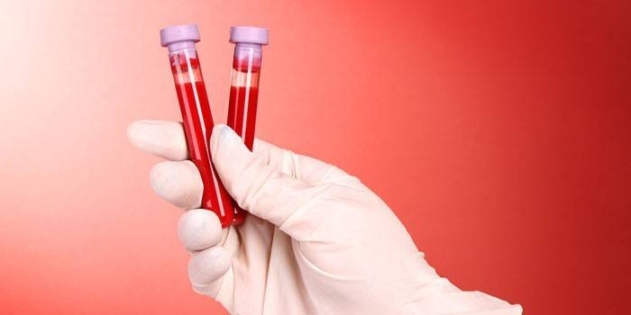 Analize de sânge in vitro