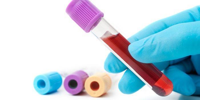 Teste de sangue in vitro