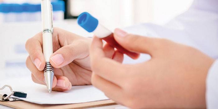 Der Arzt zeichnet die Testergebnisse auf und hält ein Reagenzglas mit Blut in der Hand