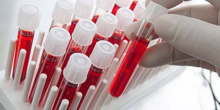 In-vitro-Blutuntersuchungen