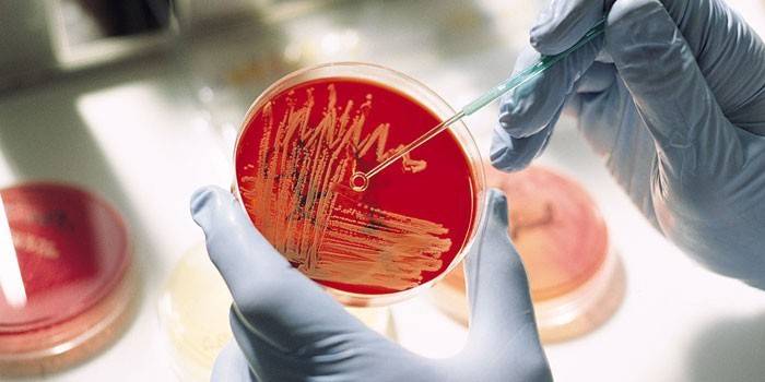 Cultura microbiologica