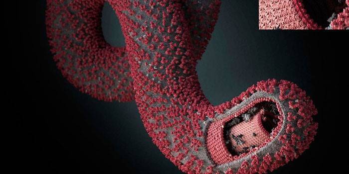 Virus dell'ebola al microscopio