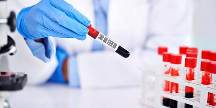 Sanitäter in Handschuhen mit einem Reagenzglas Blut