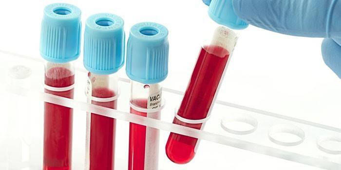 In vitro blodprøver