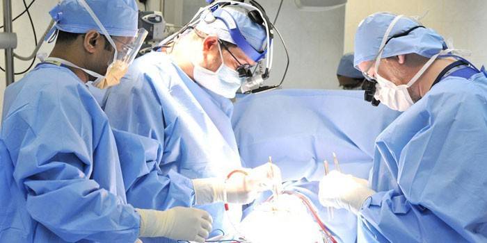 Cirurgiões na operação