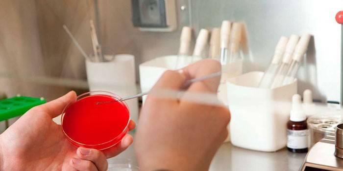 Il tecnico di laboratorio inocula il terreno di coltura in una capsula di Petri