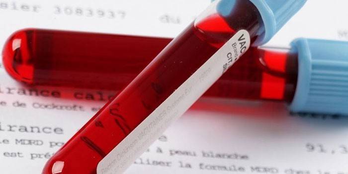 Blut Analyse