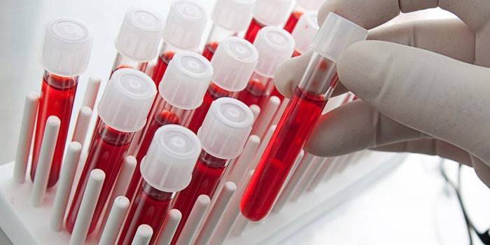 Analize de sânge in vitro