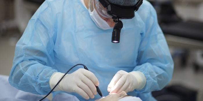 Doktor bademcikleri lazerle temizler