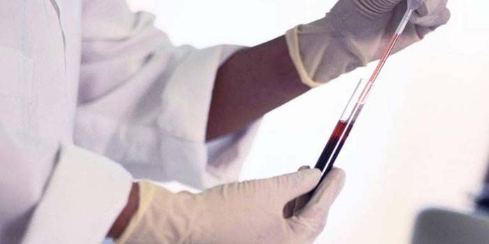 Laboratorija atlieka kraujo tyrimus