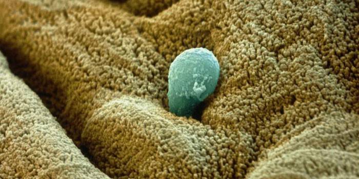 Ameba dissenterica al microscopio