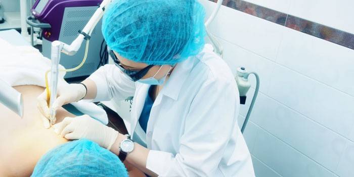 Il medico rimuove una gallina sulla schiena