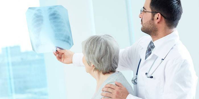 Le médecin montre une radiographie à une femme âgée