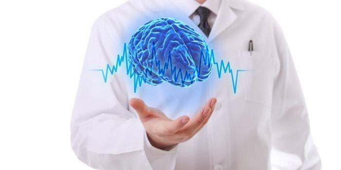 neurologo