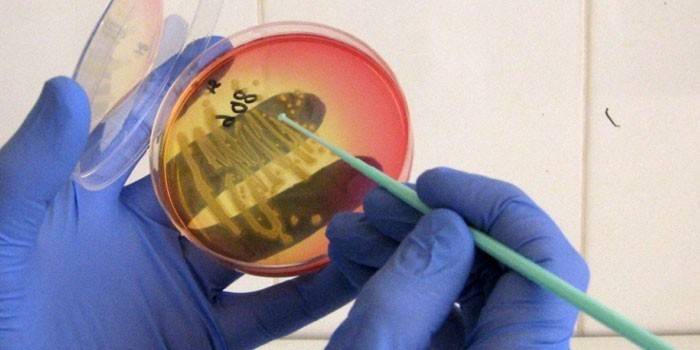 Petri trauks ar baktērijām laboratorijas palīga rokās