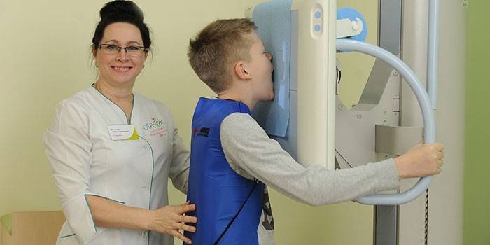 Radiografie a unui băiat