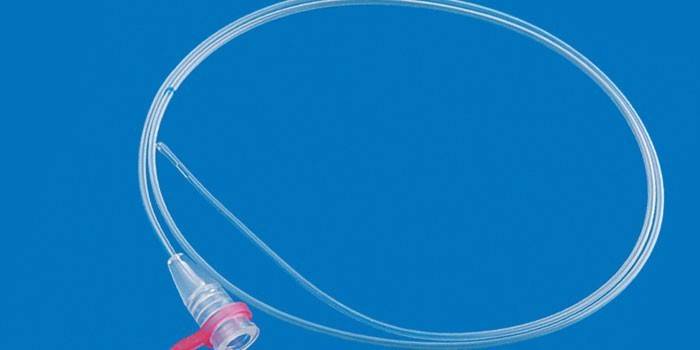 Tub gastric