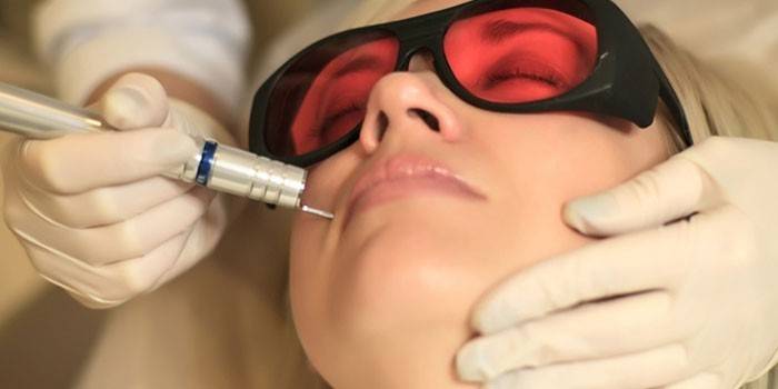 La fille enlève une taupe sur son visage