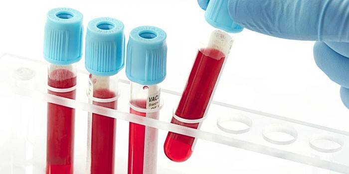 Δοκιμές αίματος in vitro