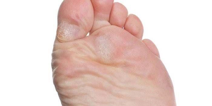 Champignon du pied