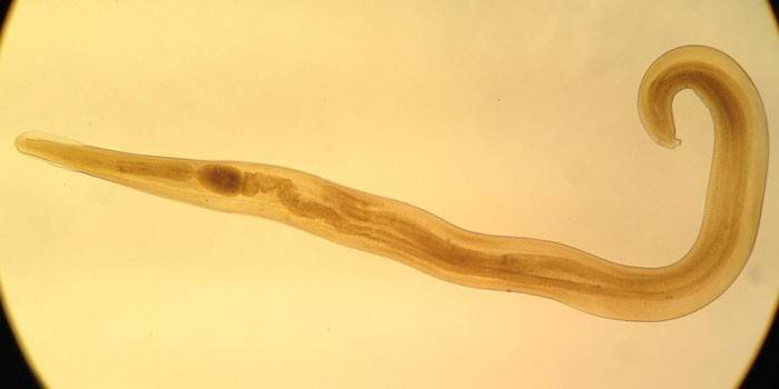 Pinworm parazita