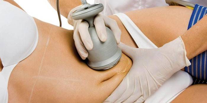 La ragazza sta subendo cavitazione ad ultrasuoni