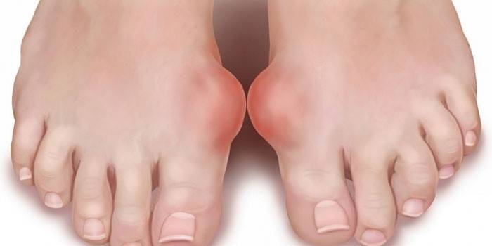 Gotta ai piedi