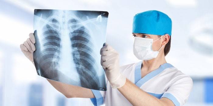 Medicul se uită la o poză cu plămânii