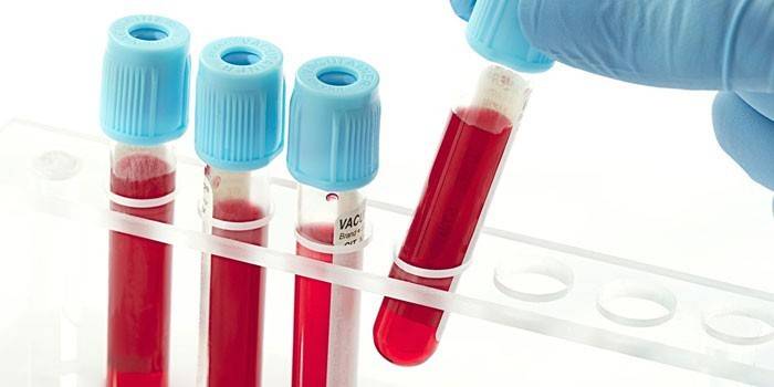 Δοκιμές αίματος in vitro