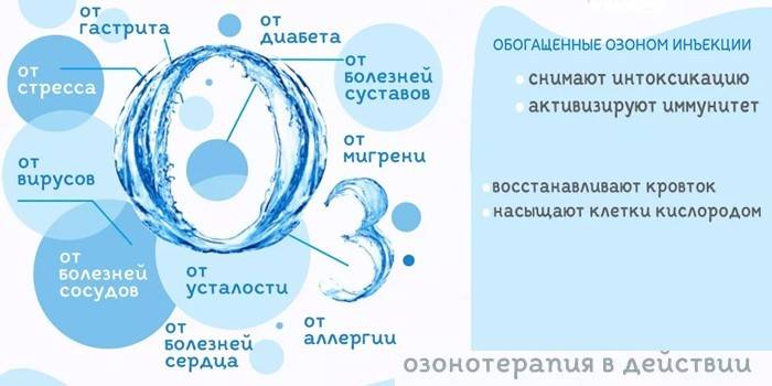 Терапеутски ефекат озона