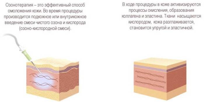 Утицај терапије на кожу