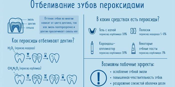 Λεύκανση δοντιών υπεροξειδίου