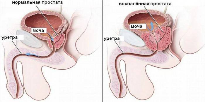 Sơ đồ hệ thống sinh dục nam