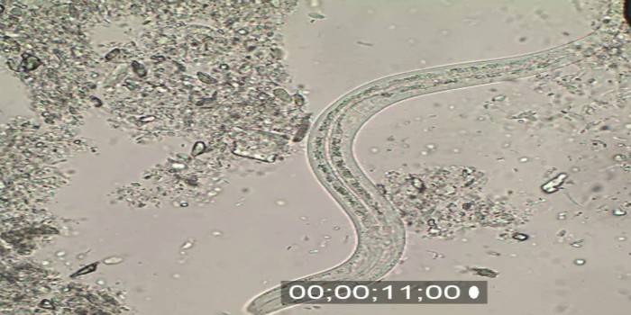 Acne intestinale al microscopio