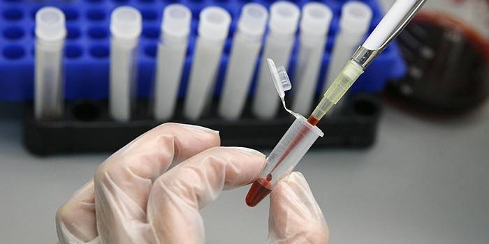 Medic thực hiện xét nghiệm máu