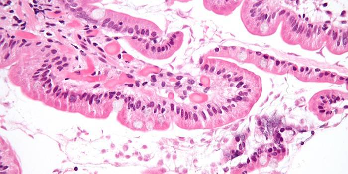Virus bajo el microscopio