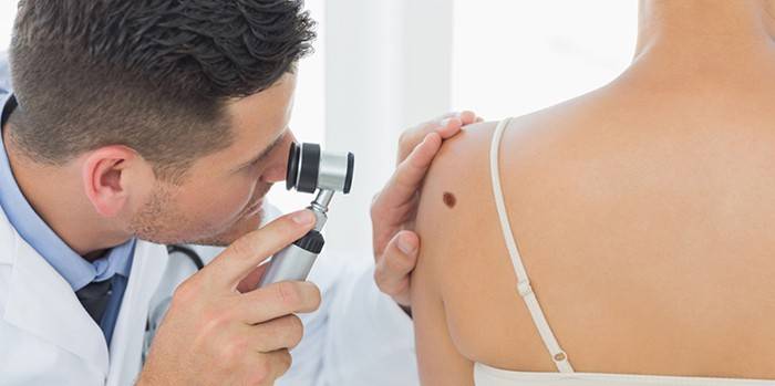 Gydytojas atlieka nevus dermatoskopiją