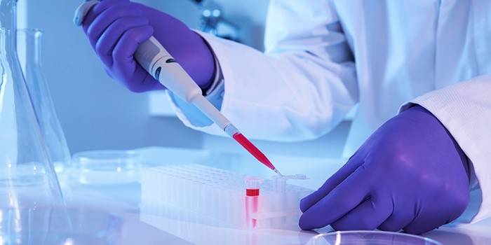 Technicien de laboratoire effectue un test sanguin
