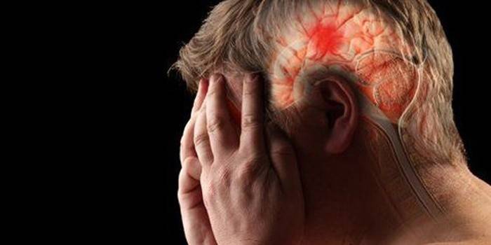 Accidente cerebrovascular