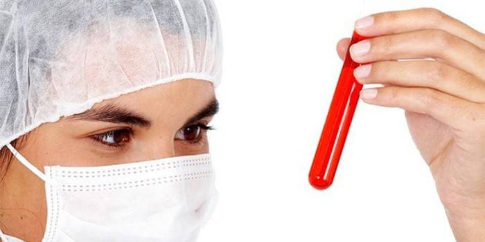 Sanitäter mit einem Reagenzglas mit Blut in der Hand