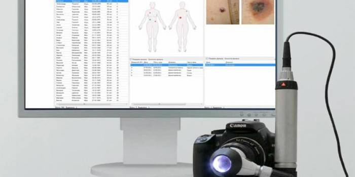 Dermatoskopijos įranga