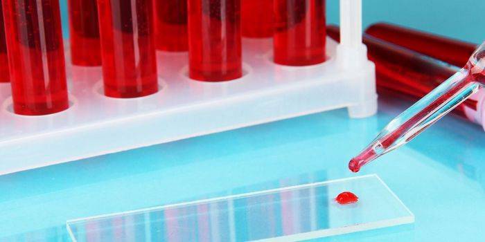 Asinis mēģenēs un laboratorijas stiklā