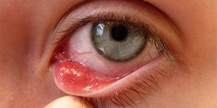 Saco conjuntival inferior no olho humano